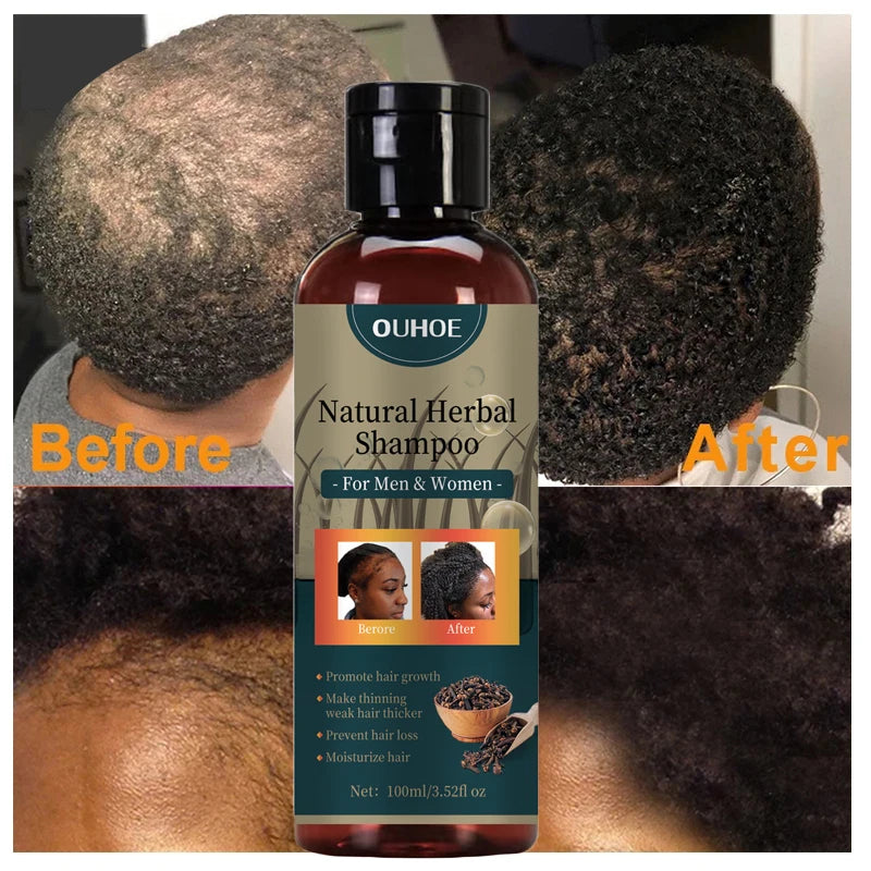 Hair Growth Shampoo Ancient African Hair Growth Formula Extract Powerful Effect Fast Hair Loss Treatment Hair Care 100Ml