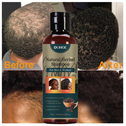 Hair Growth Shampoo Ancient African Hair Growth Formula Extract Powerful Effect Fast Hair Loss Treatment Hair Care 100Ml