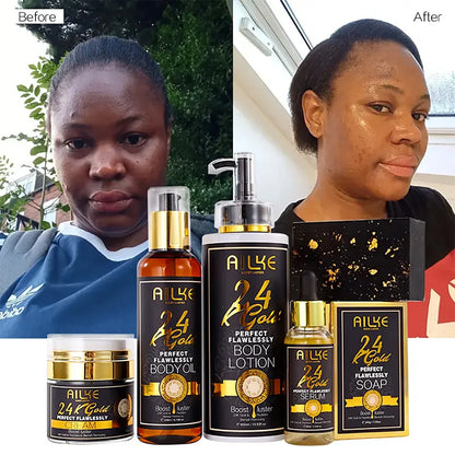 24K Whitening Skin Set, Lightening, Remove Black Spots, Melanin, Stains, Even Skin Tone, Moisturizing, for All Skin Types